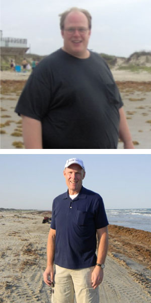 Mark Noblitt Before and After
